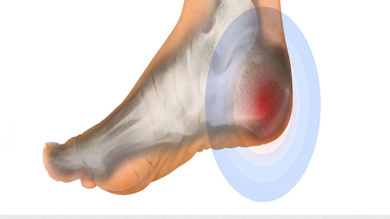 Foot And Ankle Problems Can Be Corrected By A Podiatrist In Racine, WI